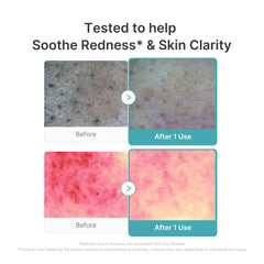 Azelaic Acid Capsule Foam Cleanser